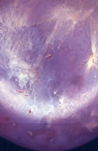 Mozambique Agate - Close-Up View