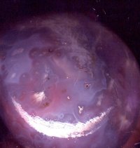Mozambique Agate - Close-Up View