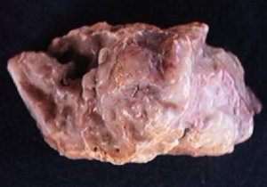 Myrickite