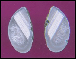 Beacon Hill Agate