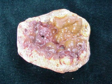 Mississippi Agate
