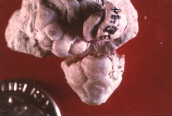 Terpnocrinus ellipticus
